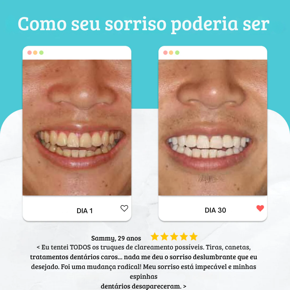 Jojoss Sonic 🦷 Uma escova de dentes inteligente para dentes mais brancos 💎