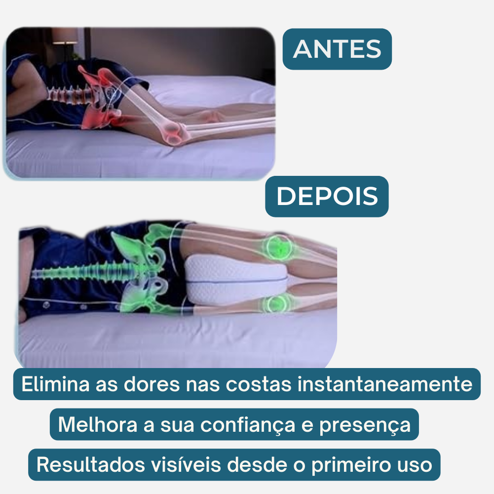 Almofada ortopédica para o joelho - Diga adeus à dor noturna 💤